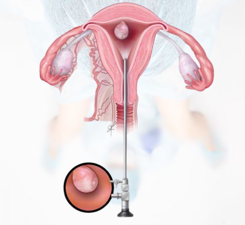 Best Hysteroscopy Doctor In Thane- Dr. Aditi Godbole