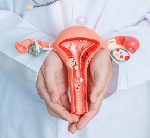 UTERINE FIBROID TREATMENT