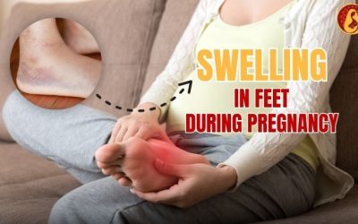 How to Reduce Swelling in Feet During Pregnancy